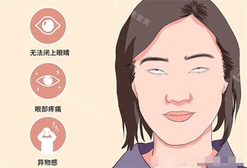 需要做眼修復(fù)的情況 需要做眼修復(fù)的情況