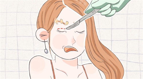 雙眼皮手術(shù)失敗修復(fù)卡通圖片 雙眼皮手術(shù)失敗修復(fù)卡通圖片