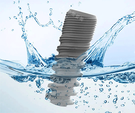 科惠种植牙怎么样