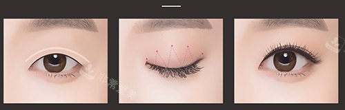 西安小艾熊医美预约挂号方便吗？多渠道可约超省心，正规机构+爆棚口碑更放心！