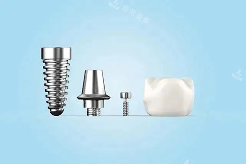 种植牙不同部件模型示意图