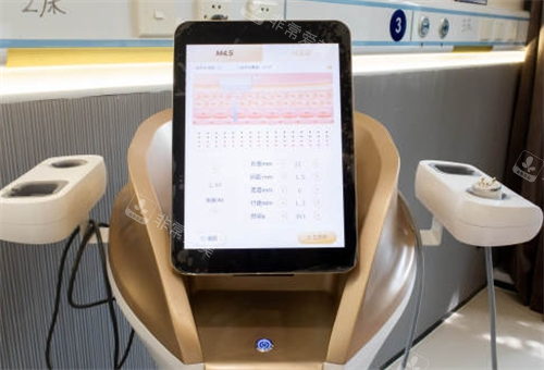 尖峰超声王显示器展示