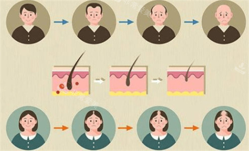 韩国纹发缝经历体验:2小时成果真的不错!