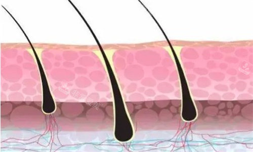 植發(fā)的毛囊 植發(fā)的毛囊