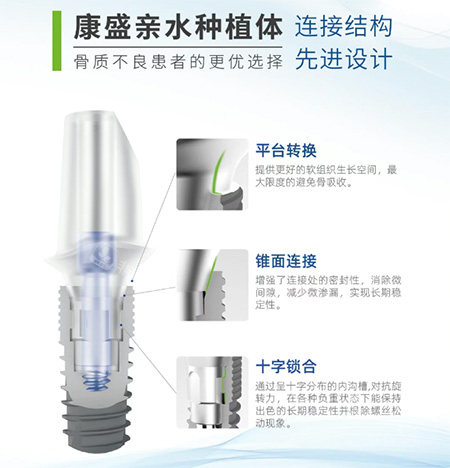 康盛亲水种植牙