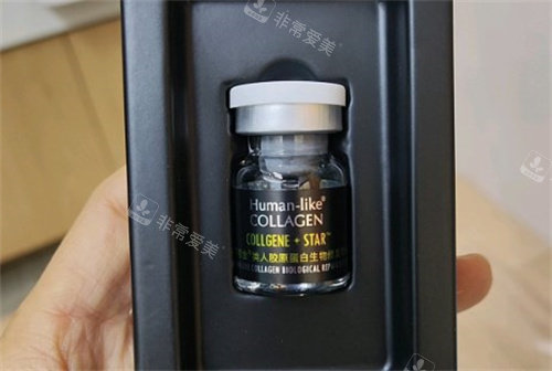 可丽金星光宝瓶