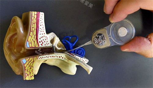 人工耳蜗和耳朵模型