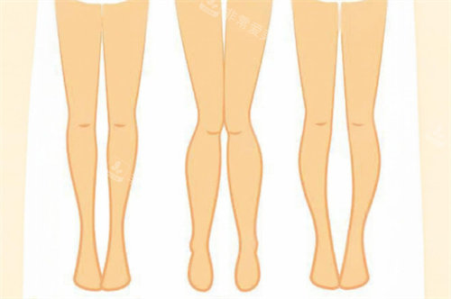 腿型对比