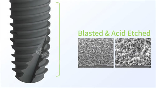 利多齿种植牙材料