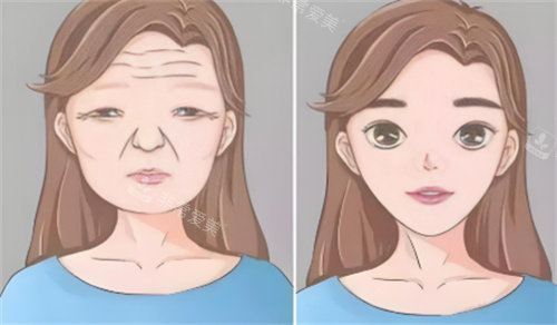 面部抗衰 面部抗衰