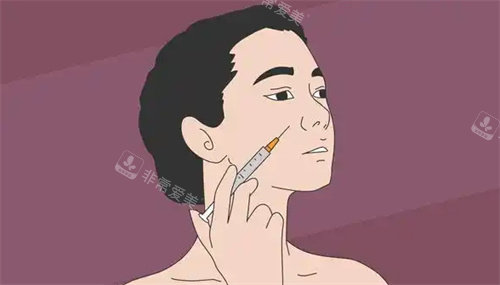 面部注射图 面部注射图