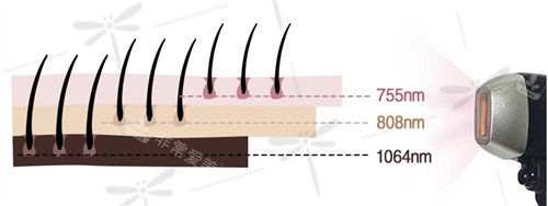 鈦提升作用層次深度 鈦提升作用層次深度