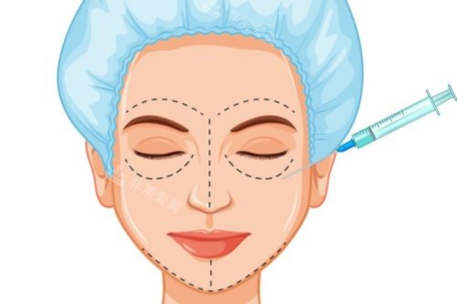 面部注射卡通图片展示 面部注射卡通图片展示