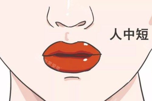 人中短卡通图 人中短卡通图
