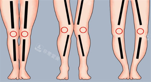 腿型动画图片 腿型动画图片