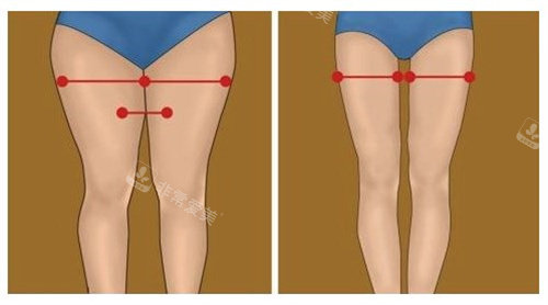 大腿对比图 大腿对比图