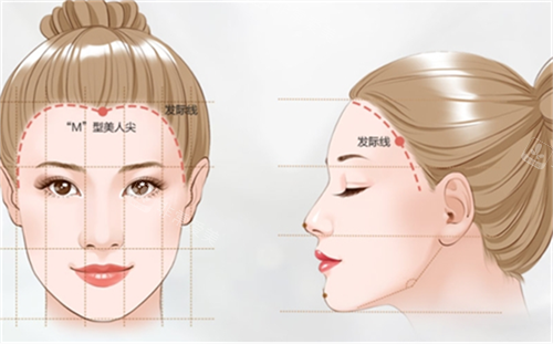 M型发际线素材 M型发际线素材