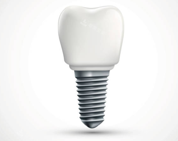 种植牙卡通图示意图