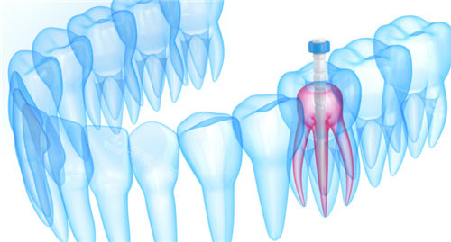 牙齿内部根管透视图