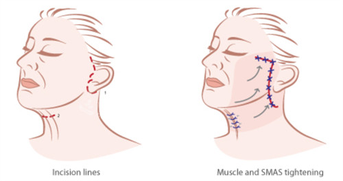 韩国bioface皮肤科怎么样？正规资质+口碑项目双在线，敏感肌修复、抗衰都靠谱！