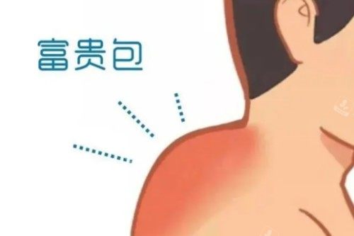 富贵包卡通展示图 富贵包卡通展示图