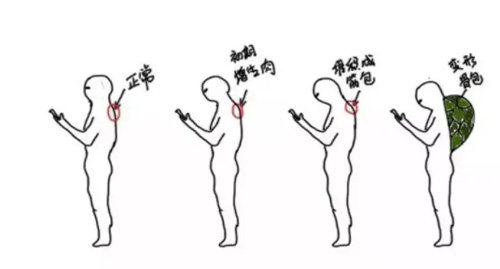 富贵包的形状 富贵包的形状