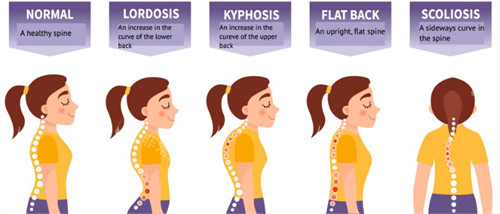 富贵包对体态的影响