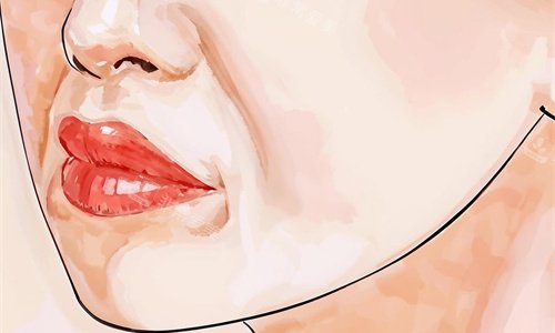 面部法令纹手绘图 面部法令纹手绘图