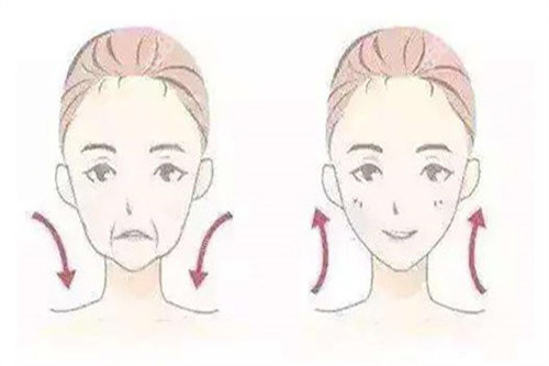 拉皮面部提升对比卡通示意图 拉皮面部提升对比卡通示意图
