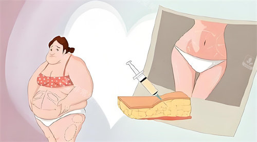 2026上海抽脂优质医生名单来袭！顾建成|李鸿君| 彭才学|张朋|何斌分层吸脂不凹凸，附术例参考