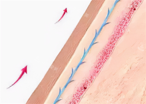 蛋白线皮肤提升细节展示