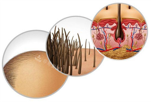 武汉仁爱医院植发科口碑医生分享：王海峰|谈雨松|杨曼植发成活率高，附多个网友诊室反馈