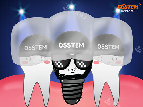 奥齿泰种植牙卡通图
