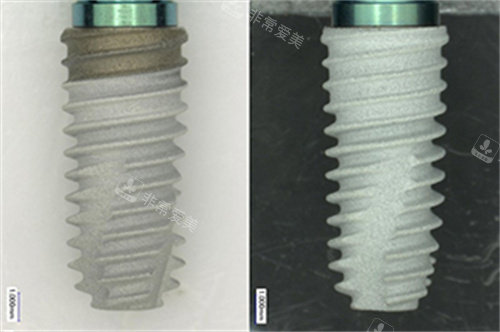 奥齿泰TS3植体实物