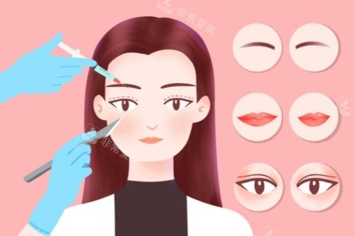 眼睛整形卡通图片展示