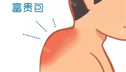 富贵包动画展示