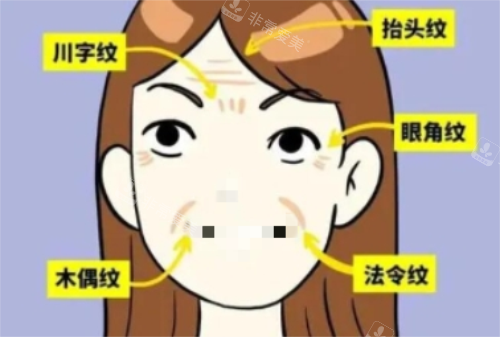 面部皱纹详细示意图