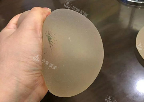 丰胸手术傲诺拉璀璨揉捏展示图