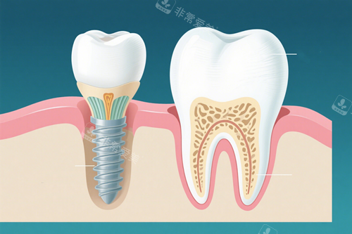 种植牙动画十一