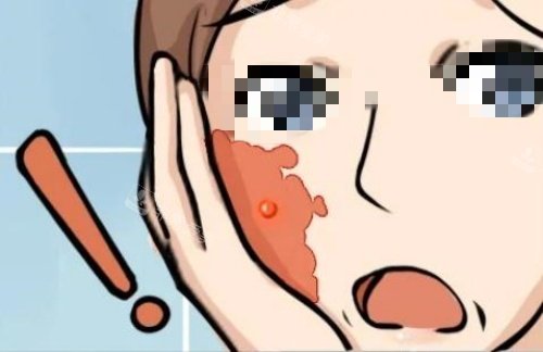 脸上胎记生长图