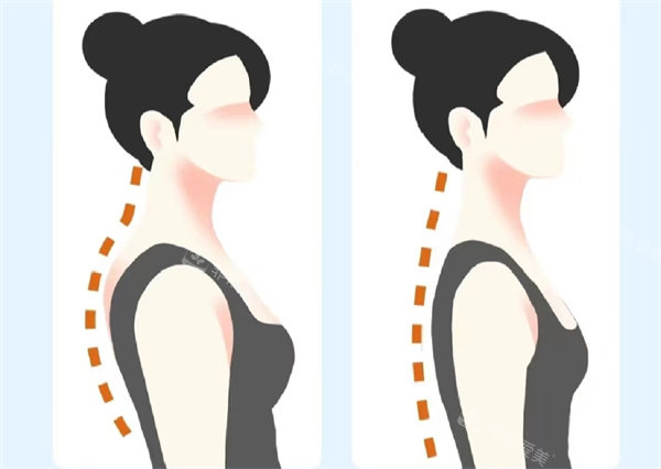 富贵包矫正手术