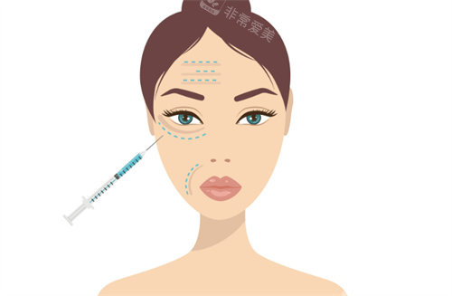 除皱针注射对比 除皱针注射对比