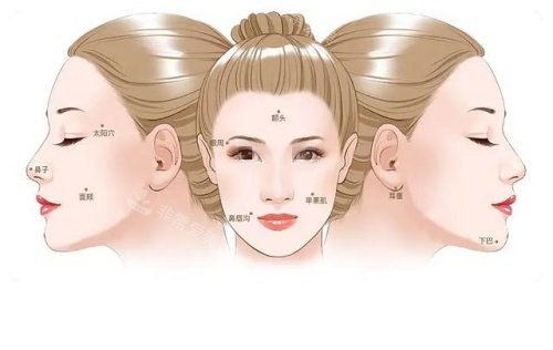 耳基低韧带提升部位示意图 耳基低韧带提升部位示意图