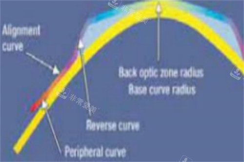 佩戴角膜塑形镜角膜受力示意图