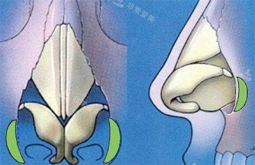 鼻部鼻背鼻头透视图