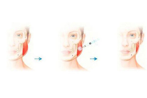 韩国清潭丽途医院怎么样？首尔抗衰人气机构|热玛吉/钛提升认证设备|医生经验超十年