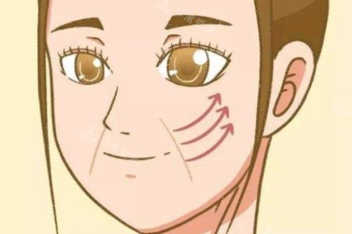 法令纹卡通图片一览 法令纹卡通图片一览