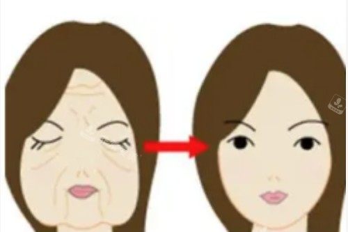 脸部衰老提升对比图