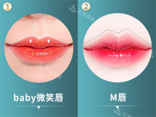 不同唇形对比图 不同唇形对比图