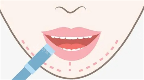 唇部画线动画图 唇部画线动画图